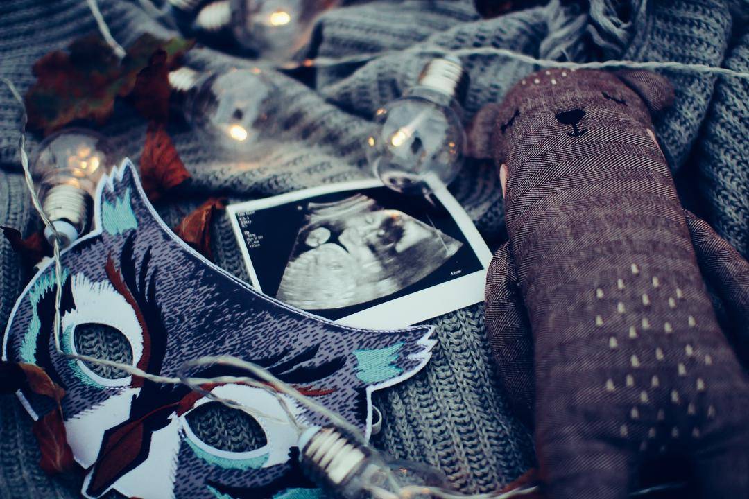 Unsplash/Daiga Ellaby