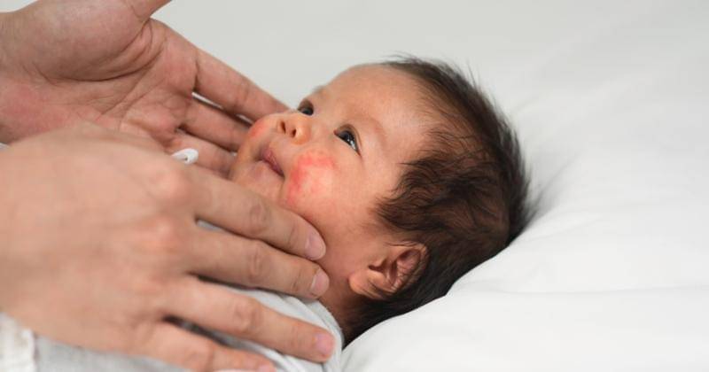 Shutterstock/fotorawin