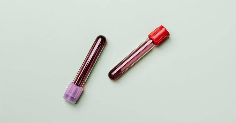 Pexels/Karolina Grabowska 