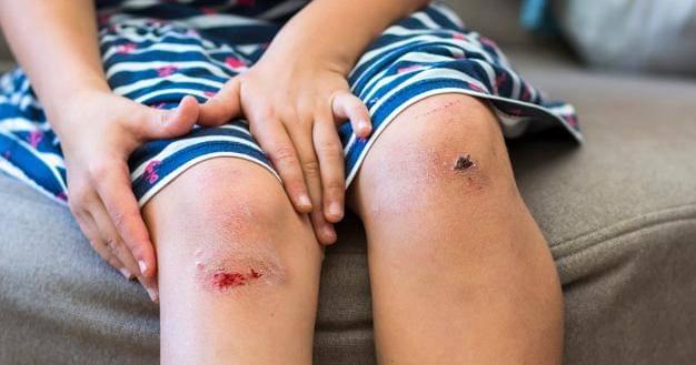 Ilustrasi - Freepik/bilanol