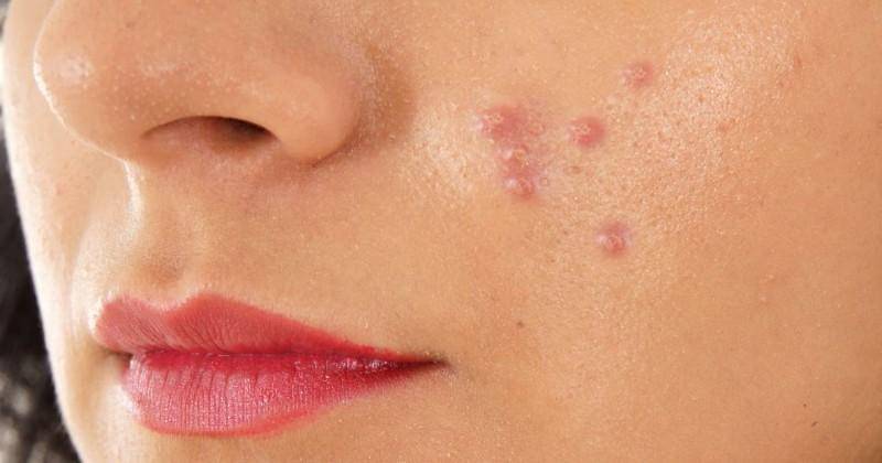 medicalnewstoday.com