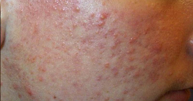 medicalnewstoday.com