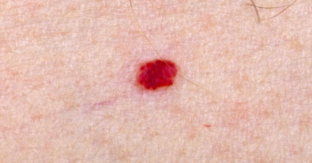 Medicalnewstoday.com