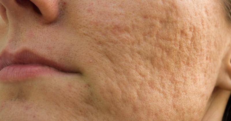 skintherapyletter.com