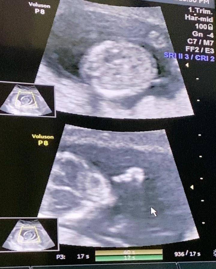 Instagram.com/dionwiyoko