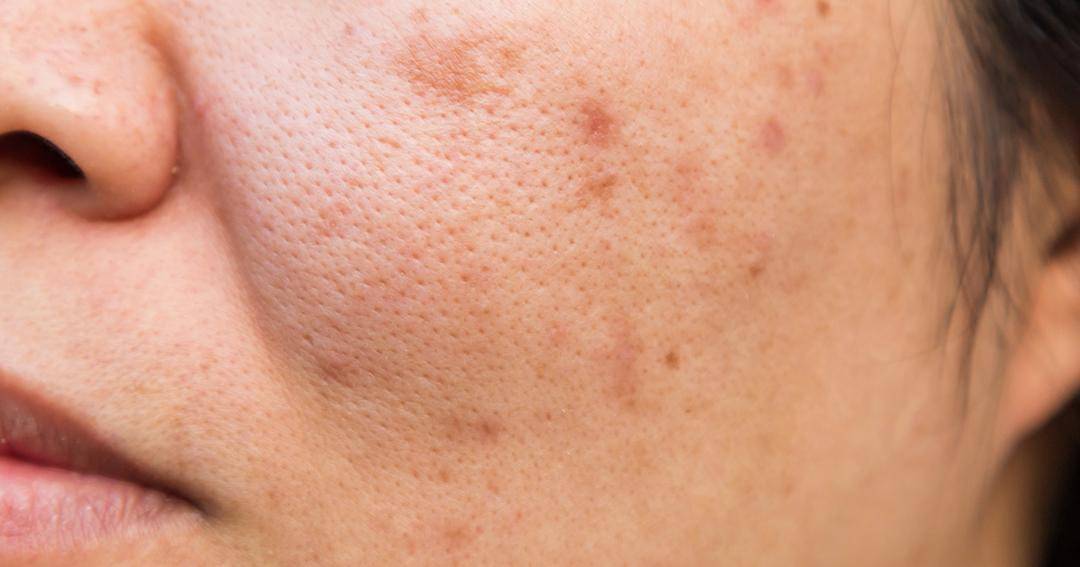 Dok. Jovee - Freepik/Suksao