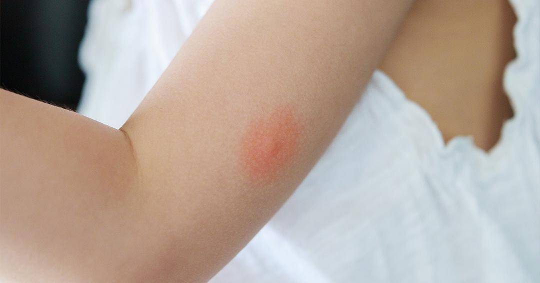 Dok. Jovee - Freepik/Kwangmoop