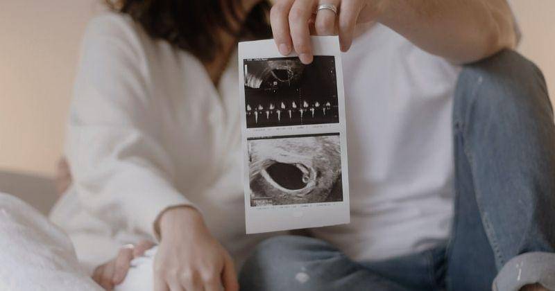 Unsplash/jonathansancheziam