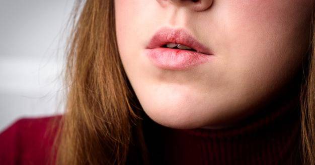 Freepik/Natali_ploskaya