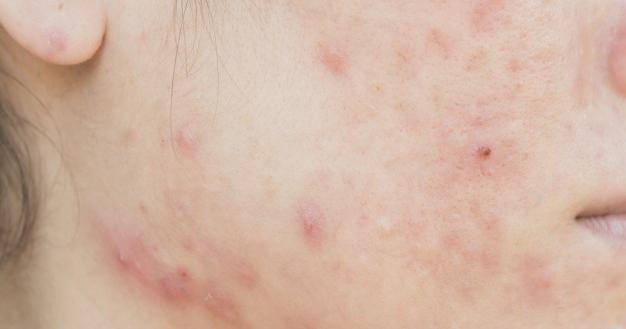 Freepik/Sri_sakorn42