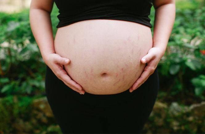 Bio-Oil: Rahasia Perawatan Kulit Sehat untuk Mama Setelah Melahirkan