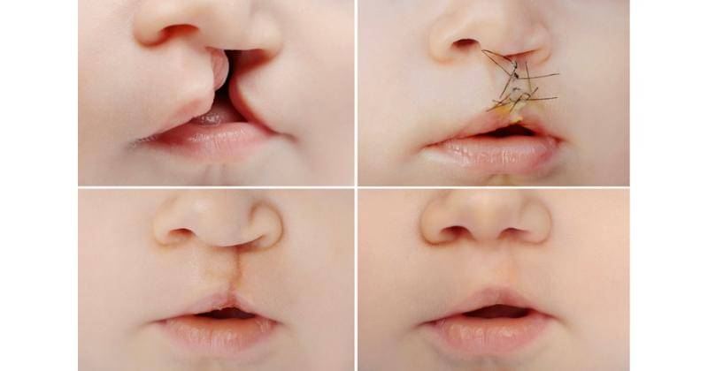 atlanticcentersurgery.com