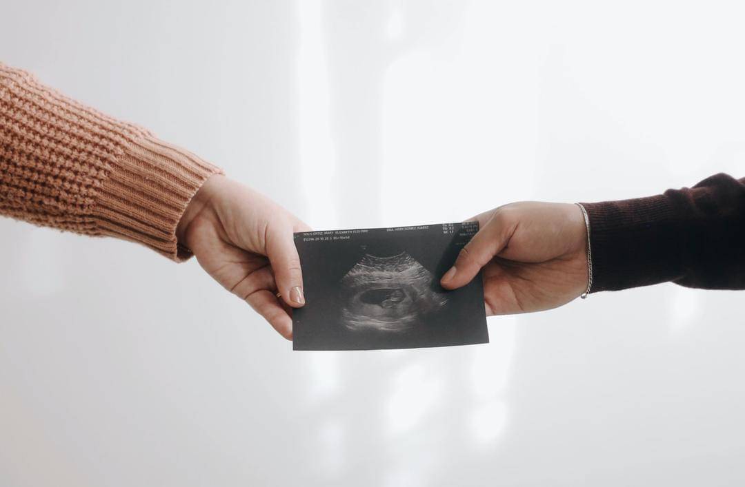 Unsplash/Jonathan Sanchez