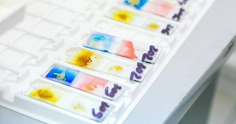 Pexels/plato-terentev