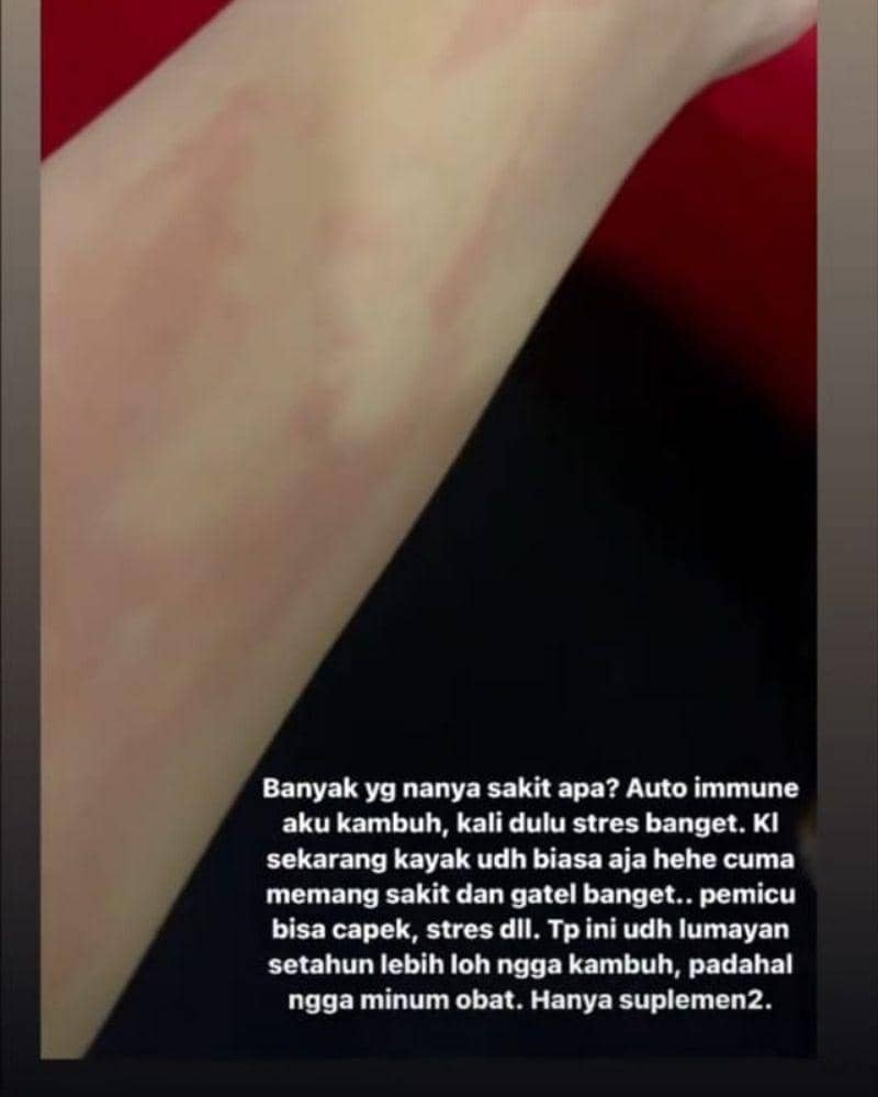 Instagram.com/ashanty_ash