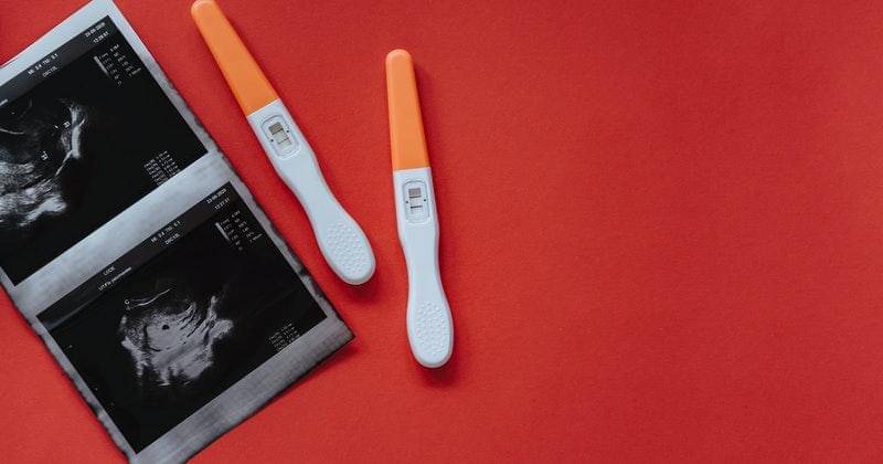 Pexels/olia-danilevich