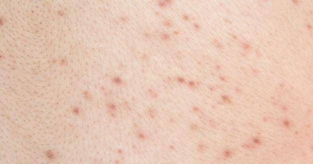 Freepik/Sri_sakorn42