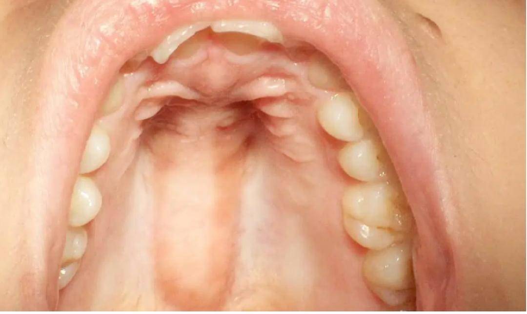 Pinterest/Healthline