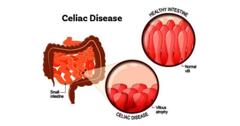 Fasbolglutenfree.com