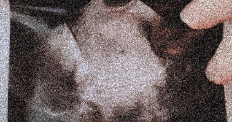 Instagram.com/attahalilintar