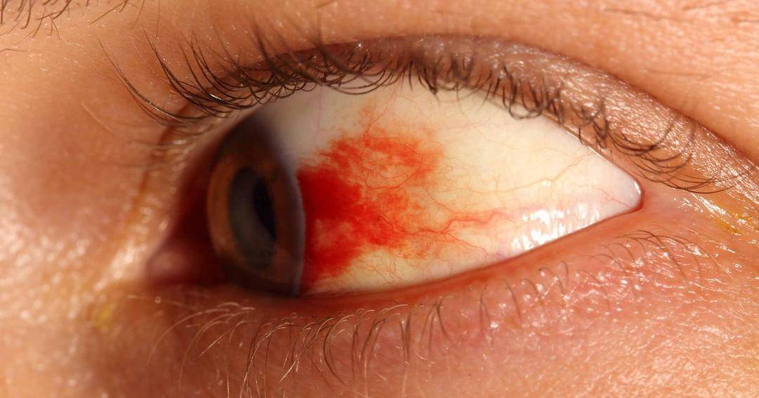 Commons.m.wikimedia.org