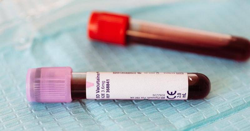 Pexels/karolina-grabowska