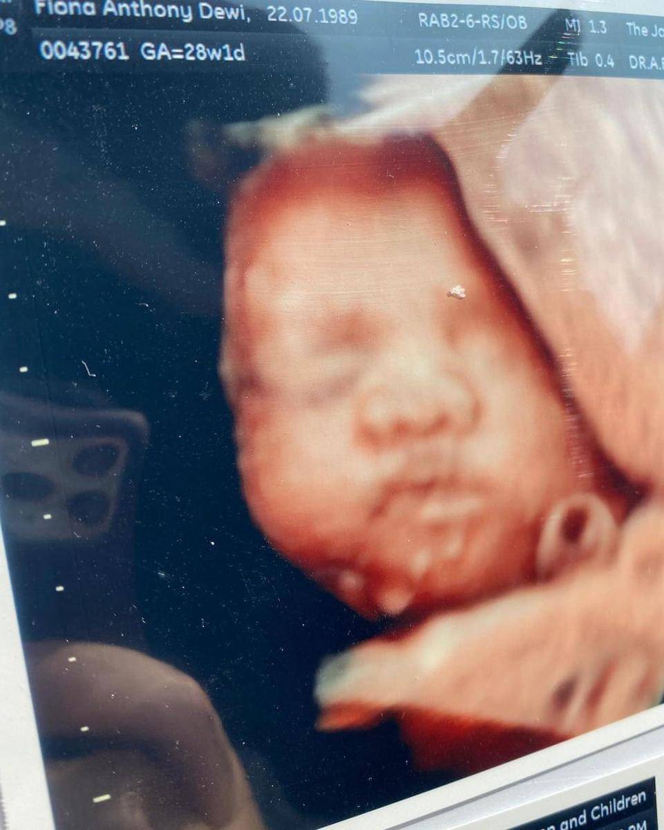 Instagram.com/fionaanthony