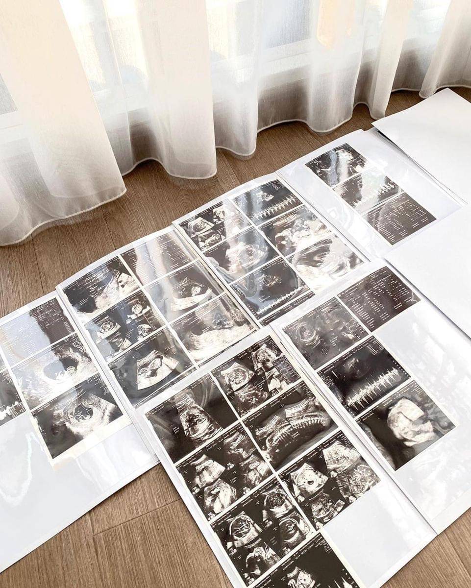 Instagram.com/fionaanthony