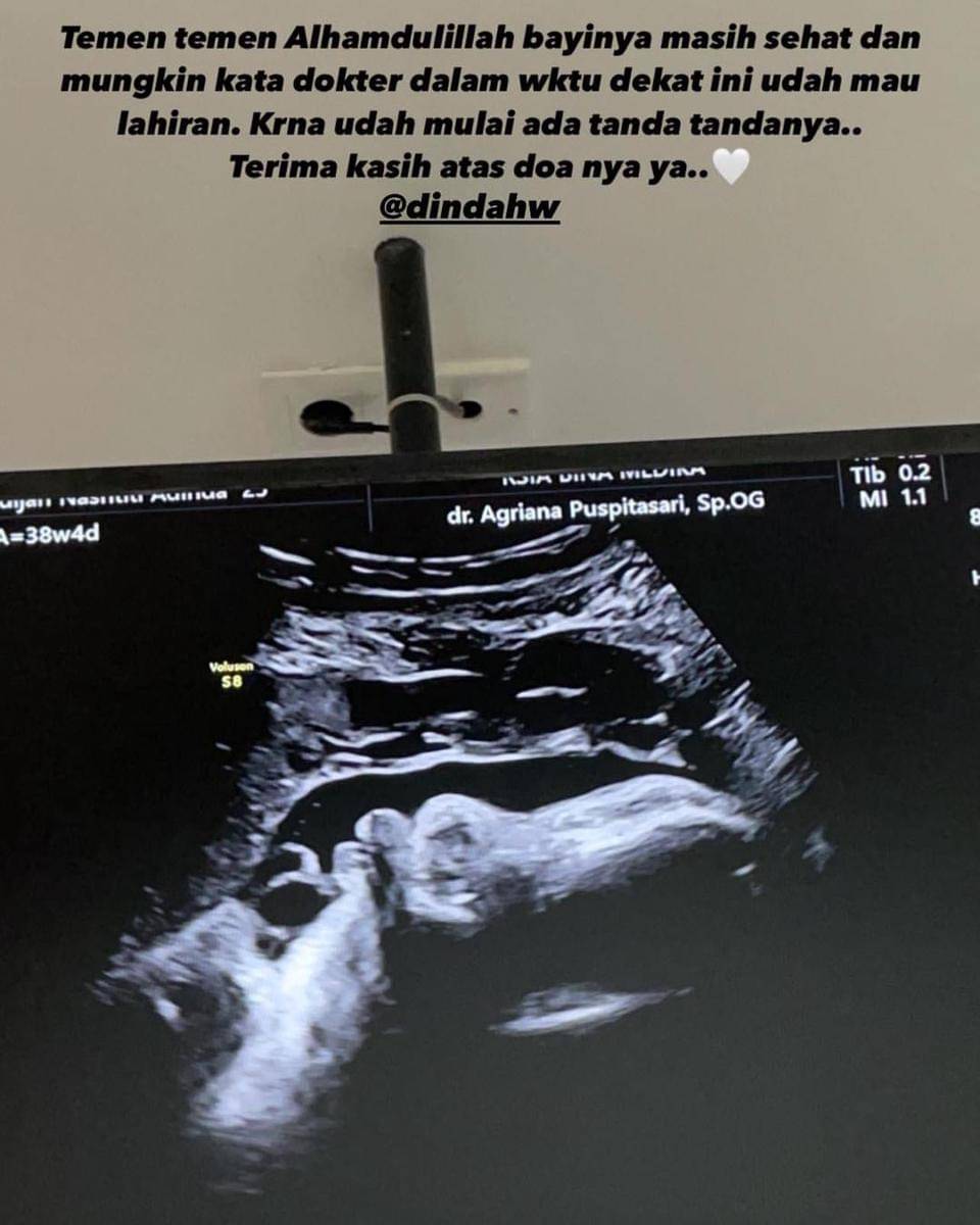 Instagram.com/rey_mbayang