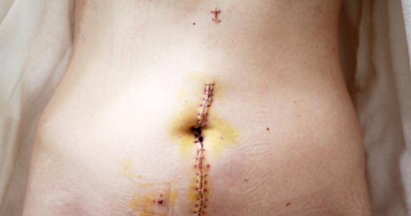 Unsplash/Sharon McCutcheon