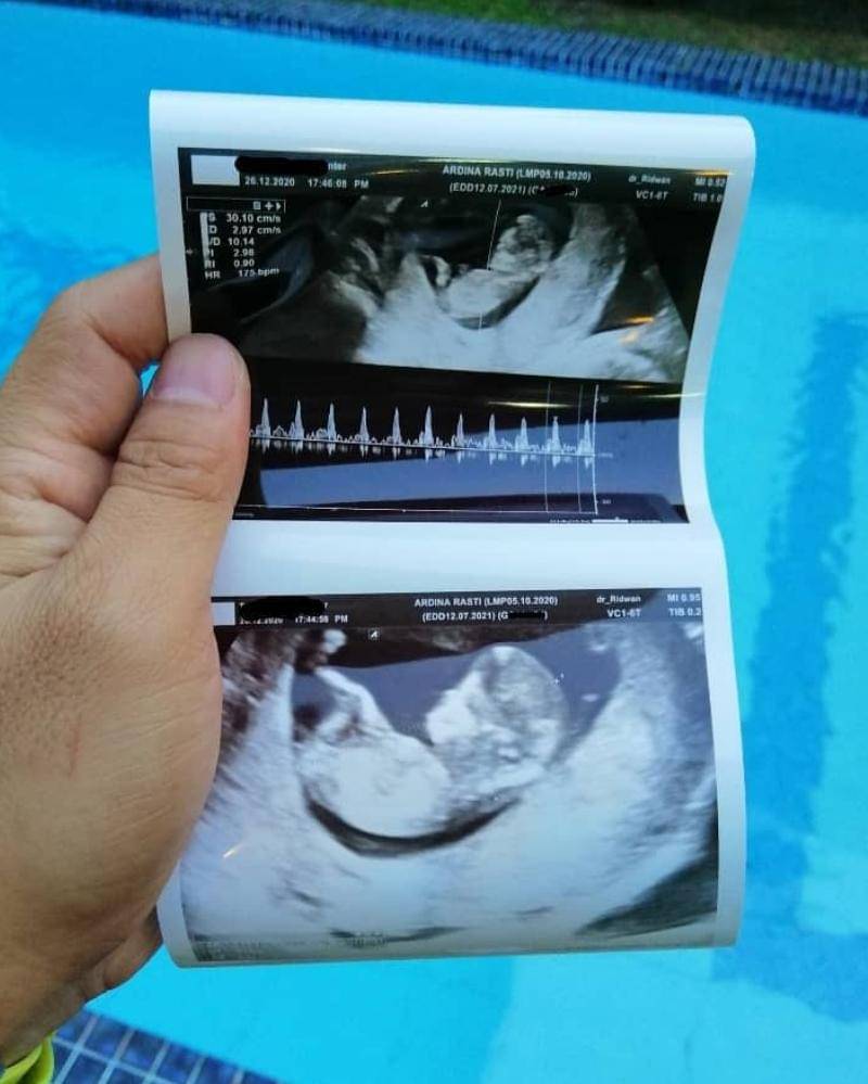 Instagram.com/arieandika10