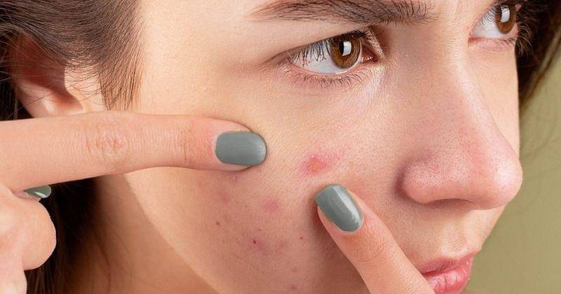 Pexels/anna-nekrashevich