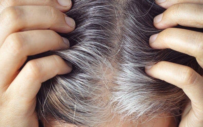Studi Ungkap Rambut Beruban Jadi Pertahanan Alami dari Risiko Kanker
