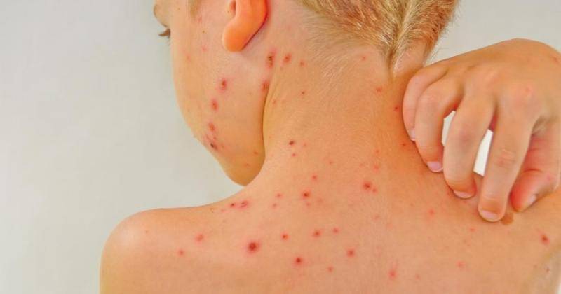 medicalnewstoday.com