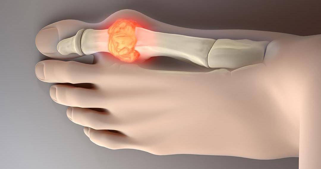 Dok. Jovee - Shutterstock/Javier Regueiro