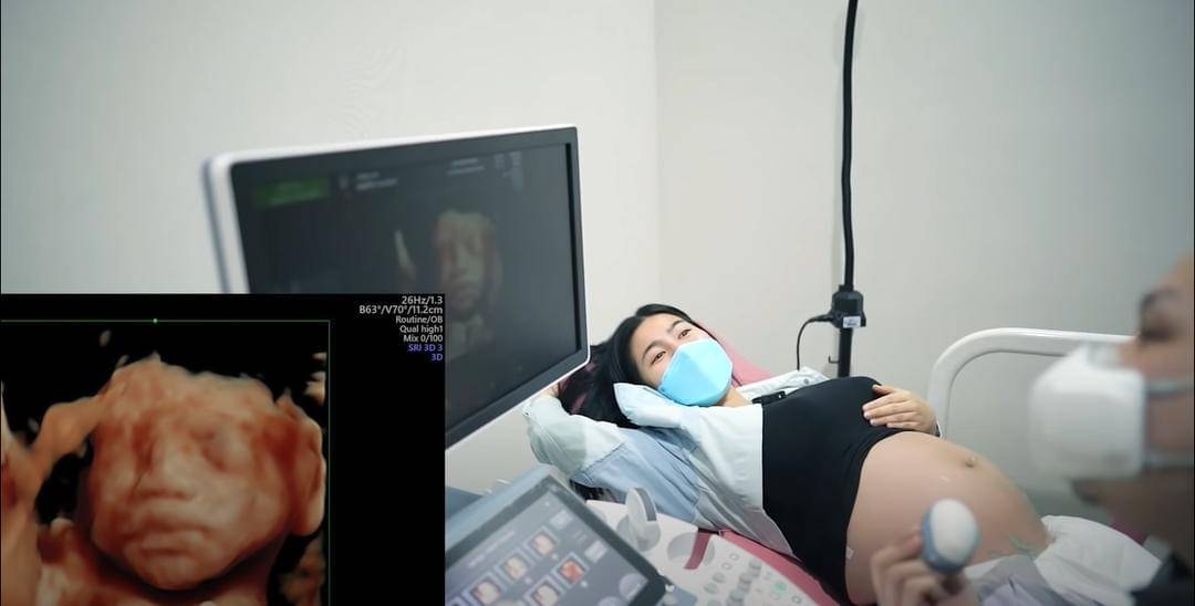 Youtube/FELITOgether Official