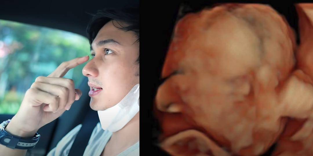 Youtube/FELITOgether Official