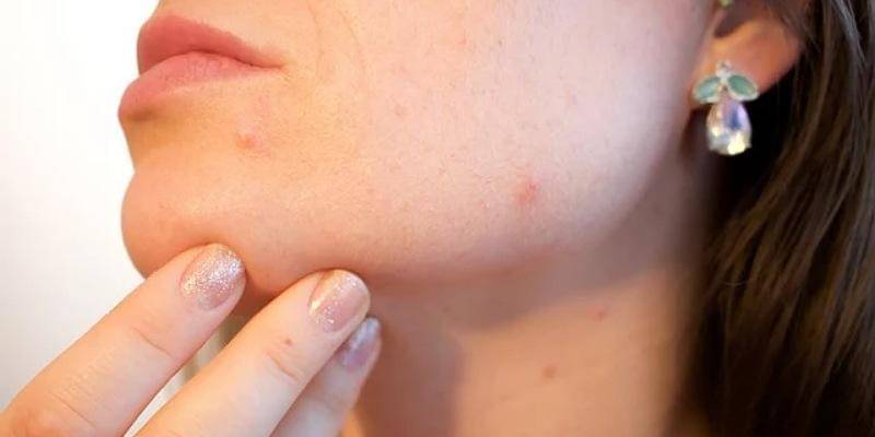 Pixabay/Kjerstin_Michaela