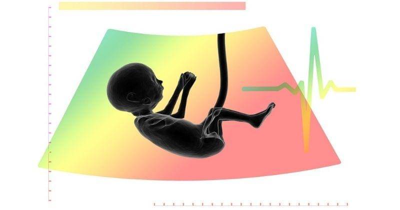 Pixabay/Gerd Altmann