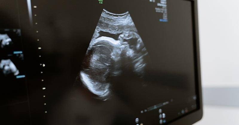 Pexels/MART PRODUCTION