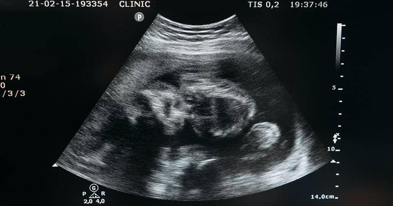 Pexels/ Pavel Danilyuk