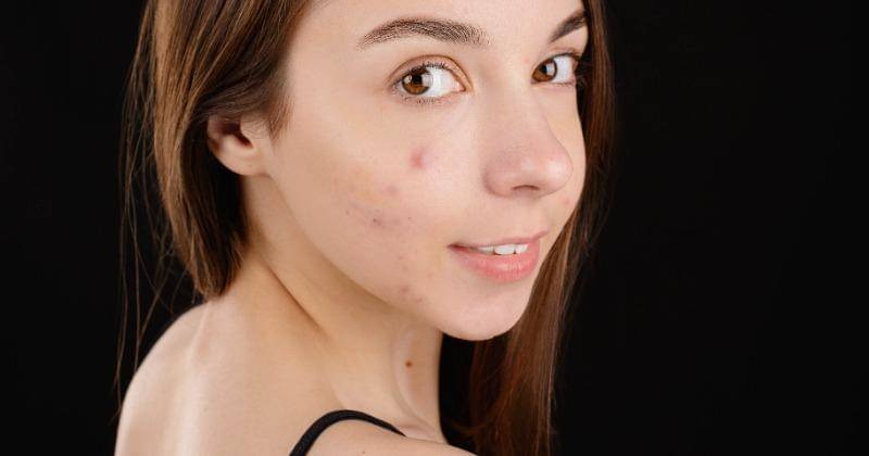 Pexels/Anna Nekrashevich