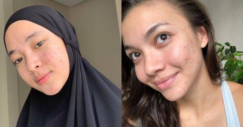 Instagram.com/nissa_sabyan | Instagram.com/angelagilsha