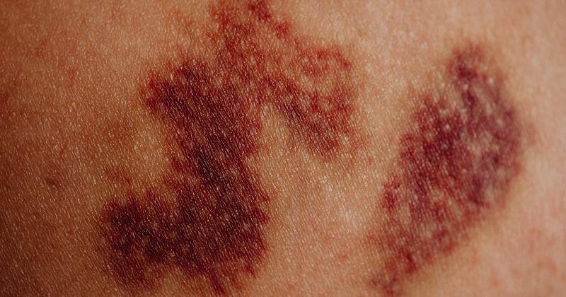 Pexels/karolina grabowska