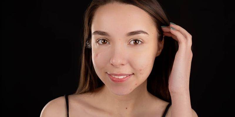 Pexels/Anna Nekrashevich