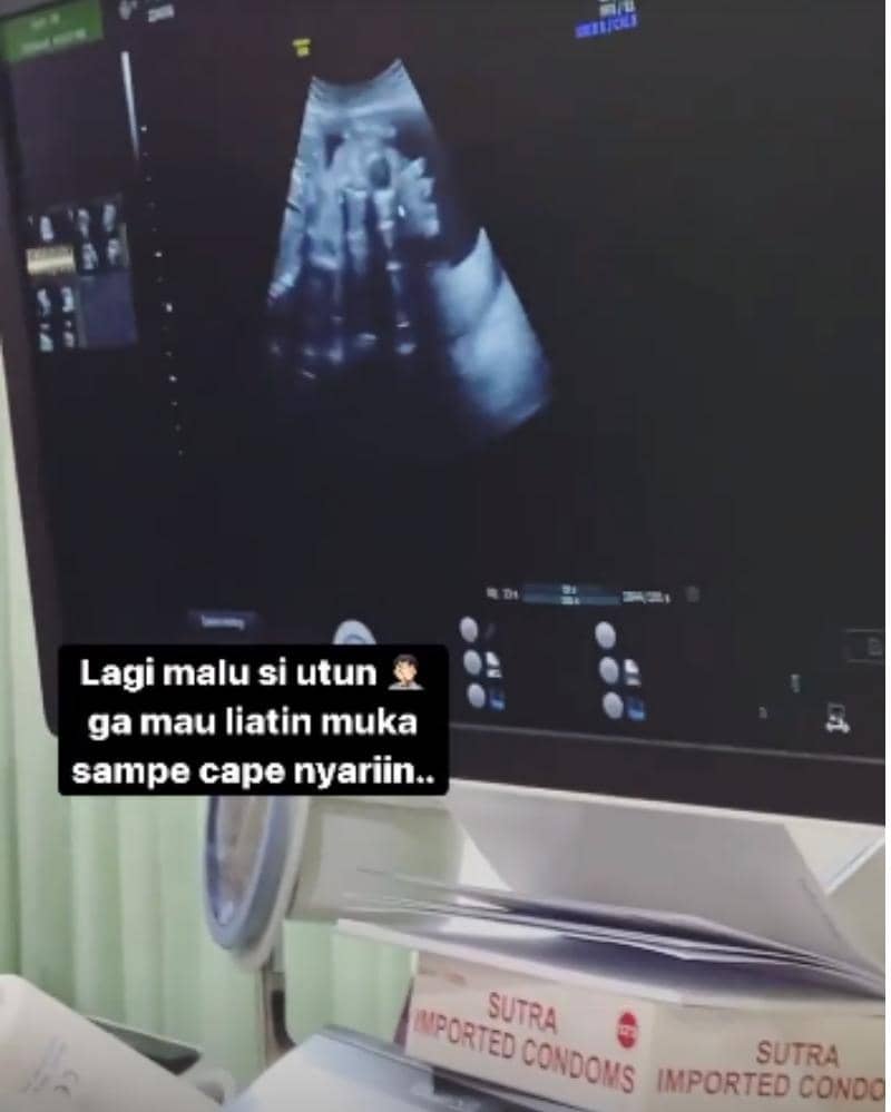 Instagram.com/rizkybillar