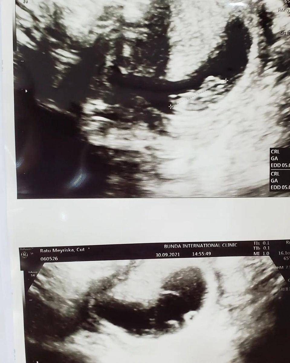 Instagram.com/rogerojey