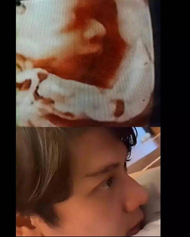 Instagram.com/rizkybillar