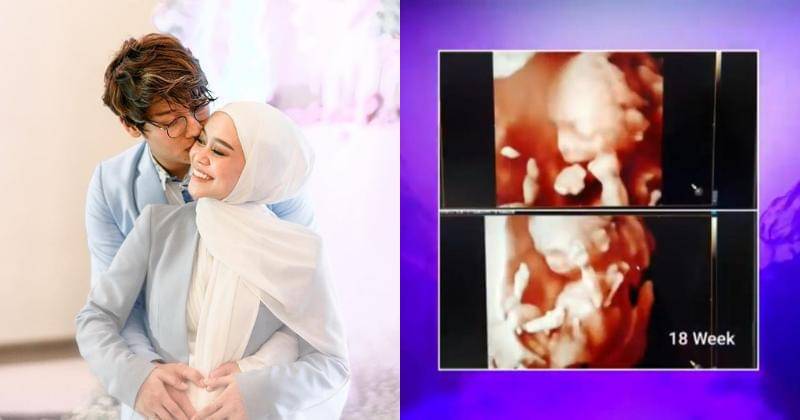 Instagram.com/lestykejora & Youtube.com/Indosiar