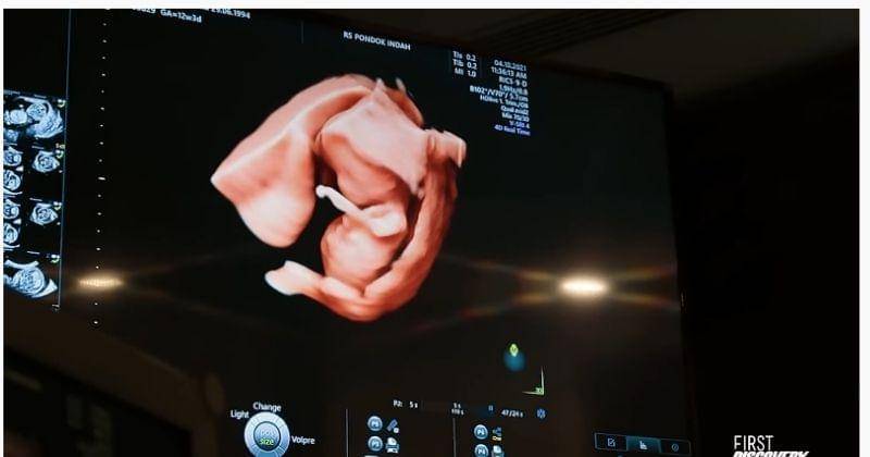 Youtube.com/Nikita Willy Official